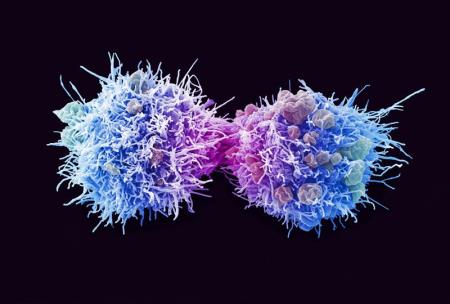 HPV in rak na materničnem vratu